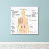 Graphique Signes Symptômes Fibromyalgie Impression (Insitu (Plancher de Bois))