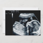 Grappig schattig avocado ultrasone fotozwangerscha aankondiging (Achterkant)