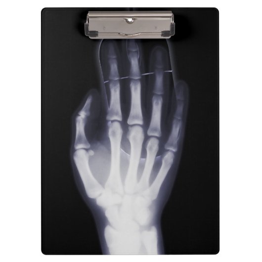 Grappige Hand X-ray Voor internet verslaafde Klembord (Voorkant)