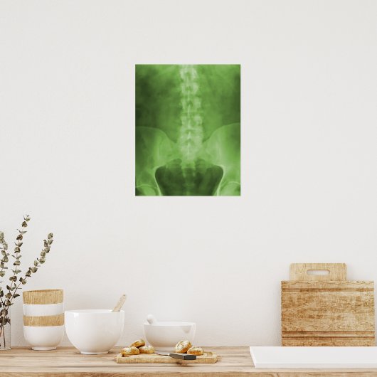 Green Digital X-Ray Art Print (Keuken)