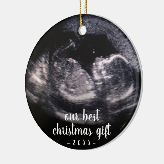 Groene Zwangerschap Ultrasound met kerstmis Keramisch Ornament (Links)