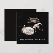 Grossesse Bébé Sonogramme Ultrasound Carte photo (Devant / Derrière)