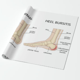 Haglund-misvorming Cadeaupapier