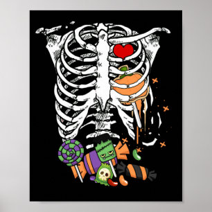 Halloween Snoep Skeleton Rib Cage X-Ray Poster
