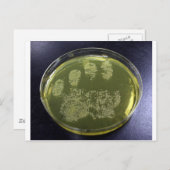 Hand Petri Dish Bacteria Briefkaart (Voorkant / Achterkant)
