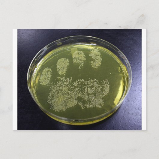Hand Petri Dish Bacteria Briefkaart (Voorkant)