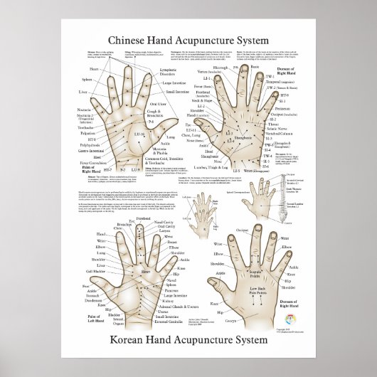 Handmatige Acupunctie Poster (Voorkant)