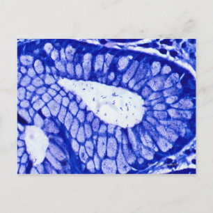 Helicobacter Pylori Briefkaart