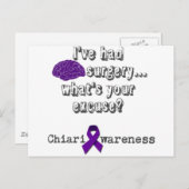 hersenchirurgie briefkaart (Voorkant / Achterkant)