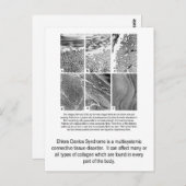 Het defecte EDS van het Collageen Briefkaart van (Voorkant / Achterkant)