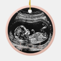 Het is een meisje echografie zwangerschap aankondi