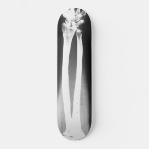 Het skateboard van Breaks van Bradley Boness