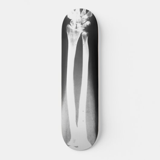 Het skateboard van Breaks van Bradley Boness (Voorkant)