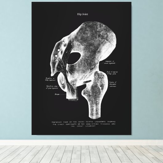 Heup Gewrichtsanatomie Medische Grote Canvaskunst Canvas Afdruk (Insitu (Houten vloer))