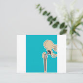 Heupgewrichtsvervanging Briefkaart (Staand voorkant)