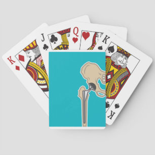 Heupgewrichtsvervanging Pokerkaarten
