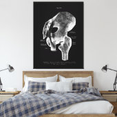 Hip Anatomie conjointe Médicale Grande toile Art (Insitu(Chambre))