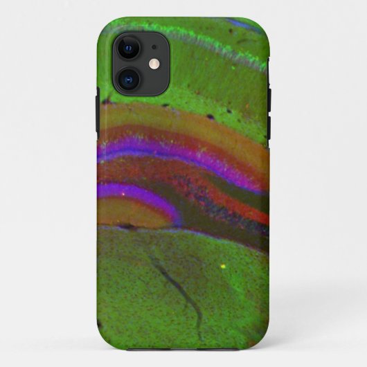 Hippocampal neuronen Case-Mate iPhone case (Achterkant)