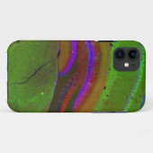 Hippocampal neuronen Case-Mate iPhone case (Achterkant (horizontaal))