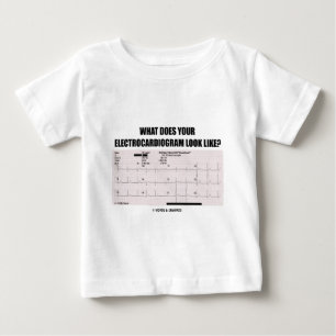 Hoe ziet je elektrocardiogram eruit?