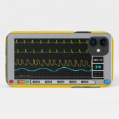 Hoesjes voor cardiale monitor iPhone en Electronic (Achterkant (horizontaal))
