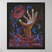 Hoop - Sickle Cell Art Print (Voorkant)