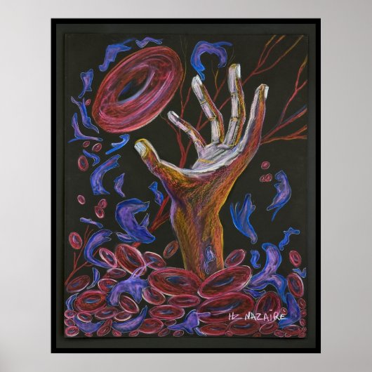 Hoop - Sickle Cell Art Print (Voorkant)