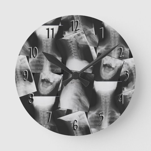 Horloge Ronde Radiographié (Recto)