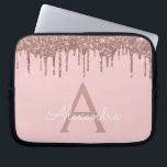 Housse Pour Ordinateur Portable Parties scintillant or rose rose vierge Étincelle<br><div class="desc">Rose Bleu - Rose Gold Faux Dripping Parties scintillant Fille moderne et élégant et Élégant Coque Monogramme Élégant. Ce coque peut être customisé pour inclure votre nom initial et prénom.</div>