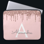 Housse Pour Ordinateur Portable Parties scintillant or rose rose vierge Étincelle<br><div class="desc">Rose Bleu - Rose Gold Faux Dripping Parties scintillant Fille moderne et élégant et Élégant Coque Monogramme Élégant. Ce coque peut être customisé pour inclure votre nom initial et prénom.</div>