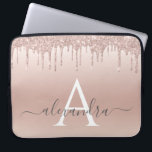 Housse Pour Ordinateur Portable Parties scintillant rose Rose or et Monogramme éti<br><div class="desc">Parties scintillant Rose Rose Gold Faux et Coque Monogramme élégant étincelant. Ce coque peut être customisé pour inclure votre nom initial et prénom.</div>