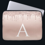 Housse Pour Ordinateur Portable Parties scintillant rose Rose or et Monogramme éti<br><div class="desc">Parties scintillant Rose Rose Gold Faux et Coque Monogramme élégant étincelant. Ce coque peut être customisé pour inclure votre nom initial et prénom.</div>