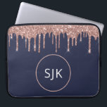 Housse Pour Ordinateur Portable Rose bleu Girly Marine Parties scintillant or  Mon<br><div class="desc">Girly Blush Pink - Rose Gold et bleu marine  Faux Parties scintillant Drips et Élégant Parkle Monogrammed Initials Coque. Ce coque peut être customisé pour inclure votre nom initial et prénom.</div>