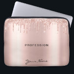 Housse Pour Ordinateur Portable Rose de Parties scintillant de maquillage Artiste<br><div class="desc">Rose de Parties scintillant tendance gouttes d'or Lashes script Rose Gold Laptop manche. Fabuleux maquillage Artiste Eyelash Lashes design avec texte de calligraphie script, parties scintillant d'or rose et arrière - plan élégant accrocheur. Personnalisez ce design de pochette pour ordinateur portable féminin en ajoutant votre nom, votre profession, choisissez votre...</div>