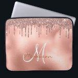 Housse Pour Ordinateur Portable Rose Parties scintillant or  Monogramme<br><div class="desc">Cette conception peut être personnalisée dans la zone fournie en modifiant la photo et/ou le texte. Vous pouvez également le customiser en cliquant sur Personnaliser ce Modèle, puis en choisissant l'option cliquer pour customiser et supprimer ou modifier la couleur de l'arrière - plan, ajouter du texte, modifier la couleur ou...</div>