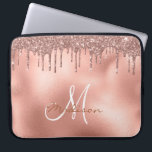 Housse Pour Ordinateur Portable Rose Parties scintillant or  Monogramme<br><div class="desc">Cette conception peut être personnalisée dans la zone fournie en modifiant la photo et/ou le texte. Vous pouvez également le customiser en cliquant sur Personnaliser ce Modèle, puis en choisissant l'option cliquer pour customiser et supprimer ou modifier la couleur de l'arrière - plan, ajouter du texte, modifier la couleur ou...</div>