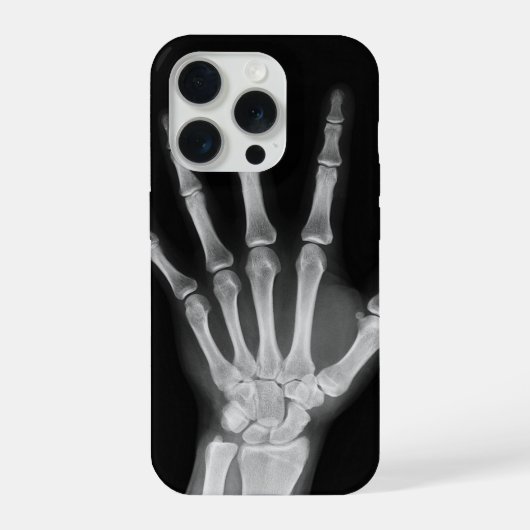 Housse Skeleton pour iPhone 15 pro (Verso)