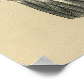 Human Hip Anatomy 1902 Print (Hoek)