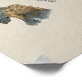 Human Niney Anatomy  Print (Hoek)