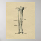 Human Tibia Anatomy 1902  Print (Voorkant)