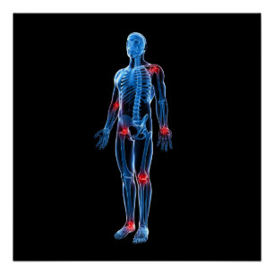 Human Xray Perfect Poster