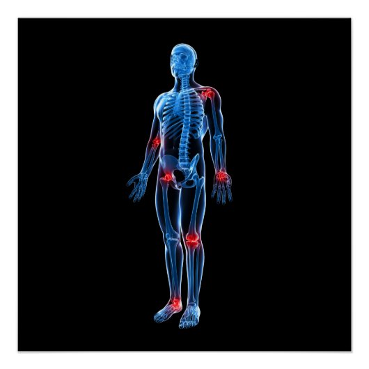 Human Xray Perfect Poster (Voorkant)