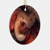 Humane embryo 7e week van de zwangerschap 5e week keramisch ornament (Rechts)