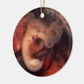 Humane embryo 7e week van de zwangerschap 5e week keramisch ornament (Links)