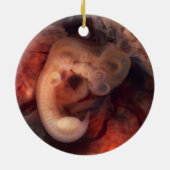 Humane embryo 7e week van de zwangerschap 5e week keramisch ornament (Achterkant)