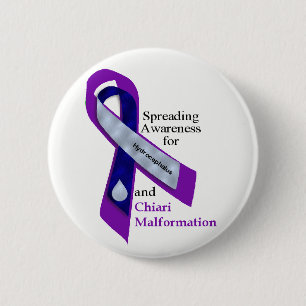 Hydrocephalus en Chiari Button