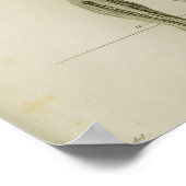  hypertensie van het lymfatisch systeem poster (Hoek)