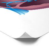 Hypoplastisch linkerhartsyndroom Poster (Hoek)