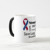 Idiopathische pulmonale fibrose Mok van bewustword (Voorkant links)