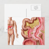 Illustratie van diverticulose in de darm briefkaart (Voorkant / Achterkant)